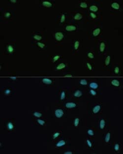 Invitrogen SET Polyclonal Antibody 100 &mu;L; Unconjugated:Antibodies,