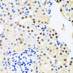 Invitrogen SET Polyclonal Antibody 100 &mu;L; Unconjugated:Antibodies,