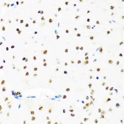 Invitrogen SET Polyclonal Antibody 100 &mu;L; Unconjugated:Antibodies,