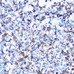Invitrogen CD43 Polyclonal Antibody 100 &mu;L | Buy Online | Invitrogen&trade; | Fisher Scientific