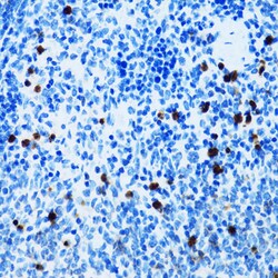 Invitrogen CD43 Polyclonal Antibody 100 &mu;L | Buy Online | Invitrogen&trade; | Fisher Scientific