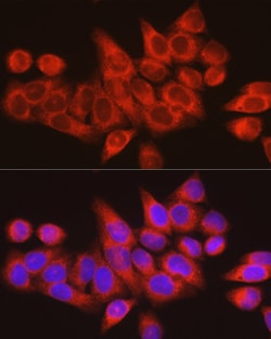 Invitrogen ARMET Polyclonal Antibody 100 &mu;L | Buy Online | Invitrogen&trade; | Fisher Scientific