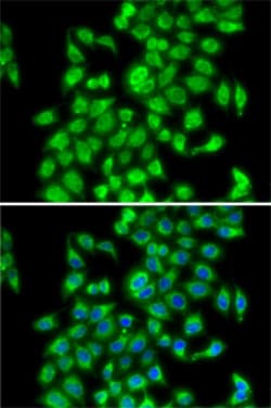 Invitrogen COPS3 Polyclonal Antibody 100 μL; Unconjugated:Antibodies,