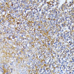Invitrogen eIF2b beta Polyclonal Antibody 100 &mu;L | Buy Online | Invitrogen&trade; | Fisher Scientific