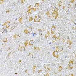 Invitrogen eIF2b beta Polyclonal Antibody 100 &mu;L | Buy Online | Invitrogen&trade; | Fisher Scientific