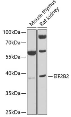 Invitrogen eIF2b beta Polyclonal Antibody 100 &mu;L | Buy Online | Invitrogen&trade; | Fisher Scientific