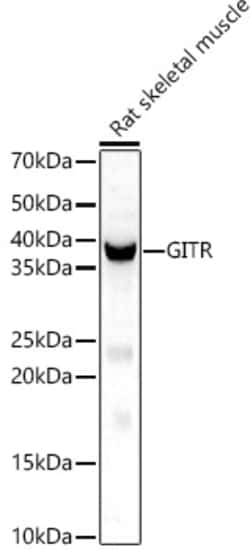 Invitrogen GITRL Polyclonal Antibody 100 &mu;L; Unconjugated:Antibodies,