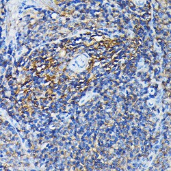 Invitrogen PRC1 Polyclonal Antibody 100 &mu;L; Unconjugated:Antibodies,