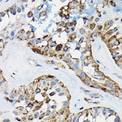 Invitrogen PRC1 Polyclonal Antibody 100 &mu;L; Unconjugated:Antibodies,