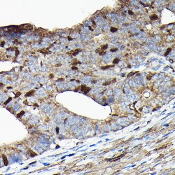 Invitrogen PRC1 Polyclonal Antibody 100 &mu;L; Unconjugated:Antibodies,