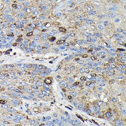 Invitrogen PRC1 Polyclonal Antibody 100 &mu;L; Unconjugated:Antibodies,