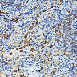 Invitrogen PRC1 Polyclonal Antibody 100 &mu;L; Unconjugated:Antibodies,