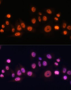 Invitrogen EFTUD2 Polyclonal Antibody 100 &mu;L; Unconjugated:Antibodies,