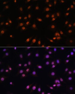 Invitrogen EFTUD2 Polyclonal Antibody 100 &mu;L; Unconjugated:Antibodies,