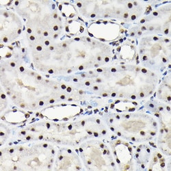 Invitrogen EFTUD2 Polyclonal Antibody 100 &mu;L; Unconjugated:Antibodies,