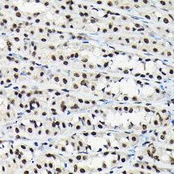 Invitrogen EFTUD2 Polyclonal Antibody 100 &mu;L; Unconjugated:Antibodies,