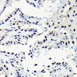 Invitrogen EFTUD2 Polyclonal Antibody 100 &mu;L; Unconjugated:Antibodies,