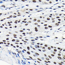 Invitrogen EFTUD2 Polyclonal Antibody 100 &mu;L; Unconjugated:Antibodies,