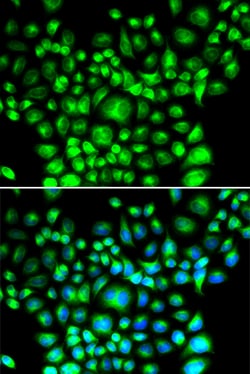 Invitrogen BAP31 Polyclonal Antibody 100 &mu;L; Unconjugated:Antibodies,