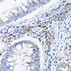 Invitrogen CD85k (Gp49b) Polyclonal Antibody 100 &mu;L; Unconjugated:Antibodies,