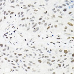 TRMT2A Polyclonal Antibody, Invitrogen 100 &mu;L; Unconjugated:Antibodies,