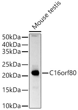 Invitrogen GTL3 Polyclonal Antibody 100 &mu;L; Unconjugated:Antibodies,