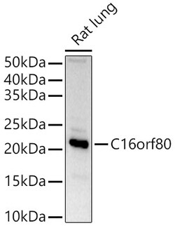 Invitrogen GTL3 Polyclonal Antibody 100 &mu;L; Unconjugated:Antibodies,