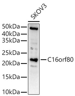 Invitrogen GTL3 Polyclonal Antibody 100 &mu;L; Unconjugated:Antibodies,