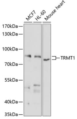Invitrogen TRMT1 Polyclonal Antibody 100 &mu;L; Unconjugated:Antibodies,