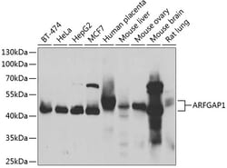Invitrogen ARFGAP1 Polyclonal Antibody 100 &mu;L; Unconjugated:Antibodies,