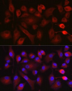 Invitrogen NOX5 Polyclonal Antibody 100 &mu;L; Unconjugated:Antibodies,
