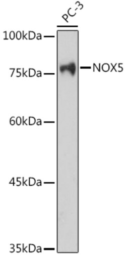 Invitrogen NOX5 Polyclonal Antibody 100 &mu;L; Unconjugated:Antibodies,