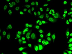 FIP1L1 Polyclonal Antibody:Antibodies, Polyclonal