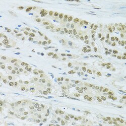 FIP1L1 Polyclonal Antibody:Antibodies, Polyclonal