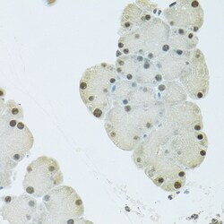 FIP1L1 Polyclonal Antibody:Antibodies, Polyclonal