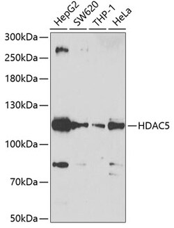 Invitrogen HDAC5 Polyclonal Antibody 100 &mu;L | Buy Online | Invitrogen&trade; | Fisher Scientific