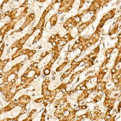 Invitrogen IDH2 Polyclonal Antibody 100 &mu;L; Unconjugated:Antibodies,