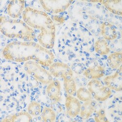 Invitrogen NAT8B Polyclonal Antibody 100 &mu;L; Unconjugated:Antibodies,