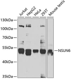 Invitrogen NSUN6 Polyclonal Antibody 100 &mu;L; Unconjugated:Antibodies,