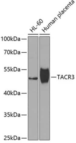 Invitrogen TACR3 Polyclonal Antibody 100 &mu;L; Unconjugated:Antibodies,