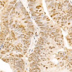 Invitrogen POLD3 Polyclonal Antibody 100 &mu;L; Unconjugated:Antibodies,