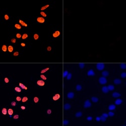Invitrogen H3K27ac Polyclonal Antibody 100 &mu;L; Unconjugated:Antibodies,