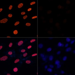 Invitrogen H3K27ac Polyclonal Antibody 100 &mu;L; Unconjugated:Antibodies,