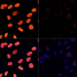 Invitrogen H3K27ac Polyclonal Antibody 100 &mu;L; Unconjugated:Antibodies,