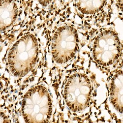 Invitrogen H3K27ac Polyclonal Antibody 100 &mu;L; Unconjugated:Antibodies,