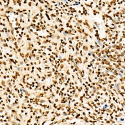 Invitrogen H3K27ac Polyclonal Antibody 100 &mu;L; Unconjugated:Antibodies,