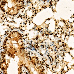 Invitrogen H3K27ac Polyclonal Antibody 100 &mu;L; Unconjugated:Antibodies,