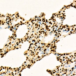 Invitrogen H3K27ac Polyclonal Antibody 100 &mu;L; Unconjugated:Antibodies,