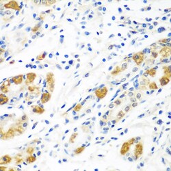 Invitrogen Flavin reductase Polyclonal Antibody 100 &mu;L; Unconjugated:Antibodies,