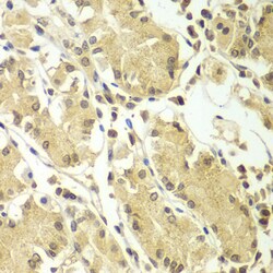Invitrogen BCAS3 Polyclonal Antibody 100 &mu;L | Buy Online | Invitrogen&trade; | Fisher Scientific
